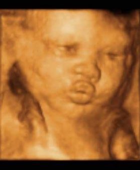 4d ultrahang kép: az első puszi
